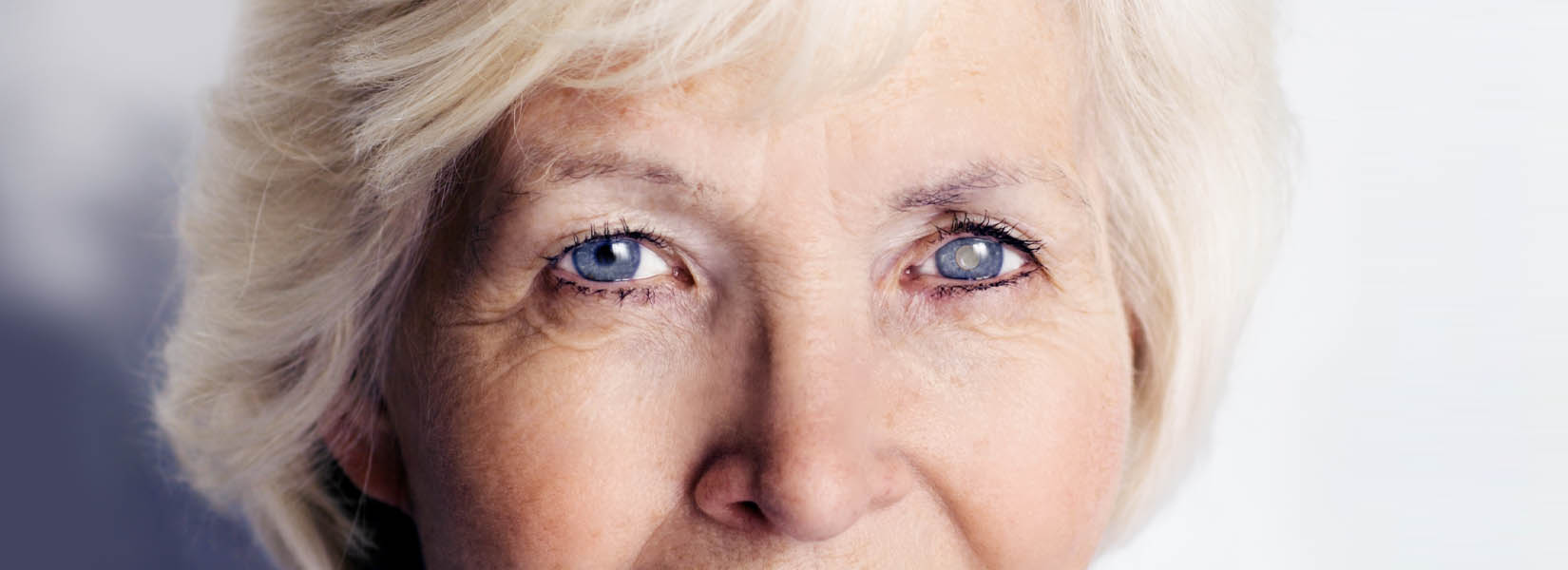 Cataract Surgery in Kingwood
